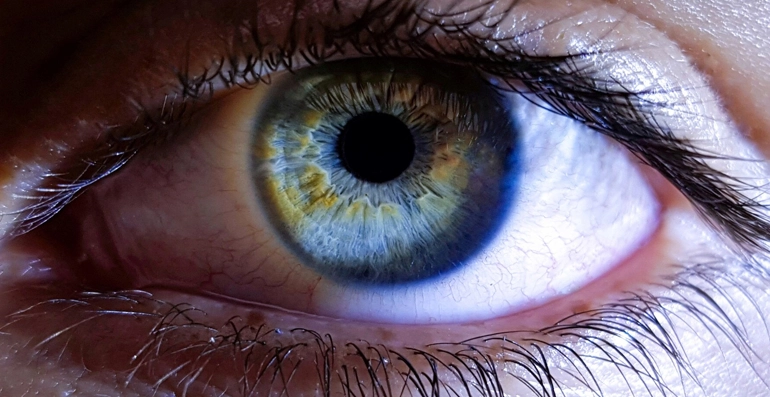 Renkli Lens